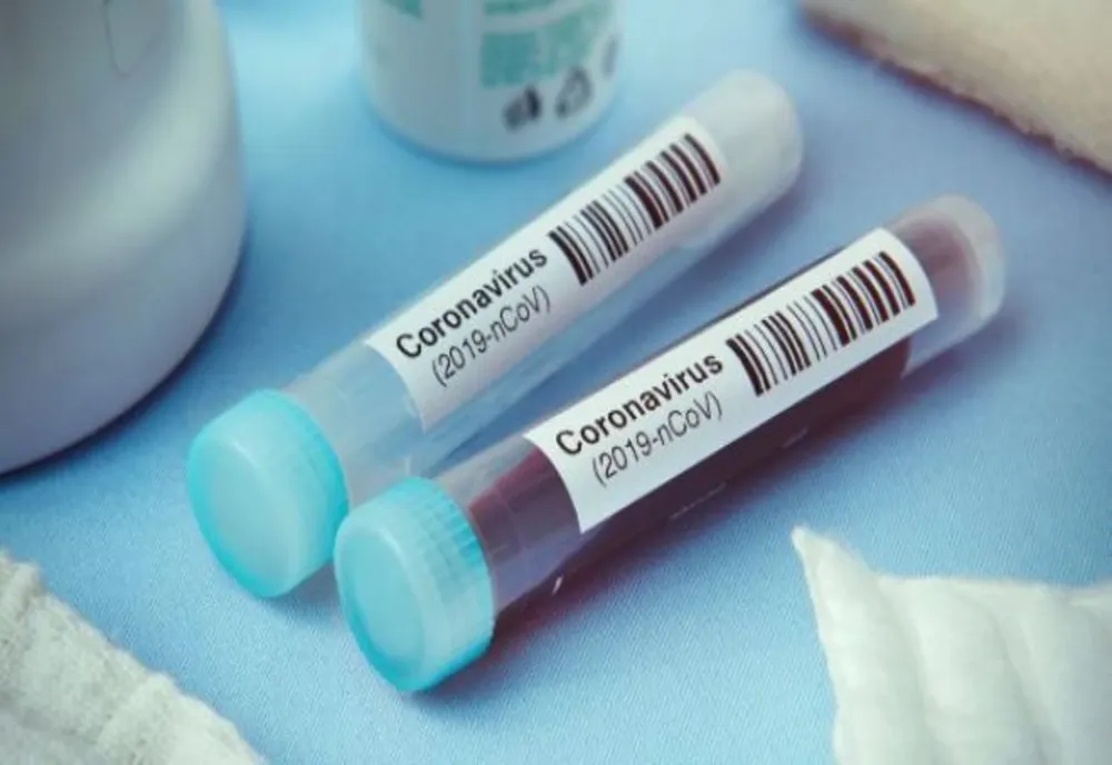 Numărul total de cazuri de coronavirus din județul Bihor a ajuns la 9