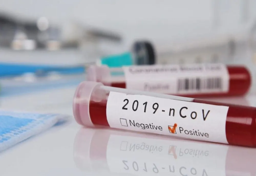 29 noi cazuri de coronavirus în România. Bilanțul ajunge la 246 de infectări