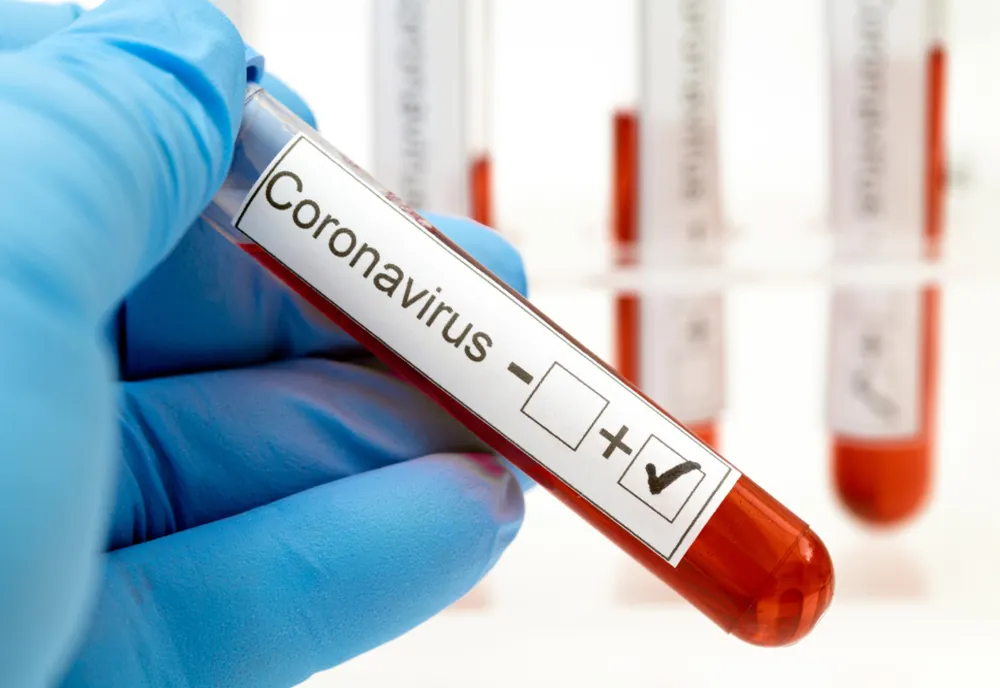 Mireasa de la nunta cu 350 de invitați din Bihor are coronavirus