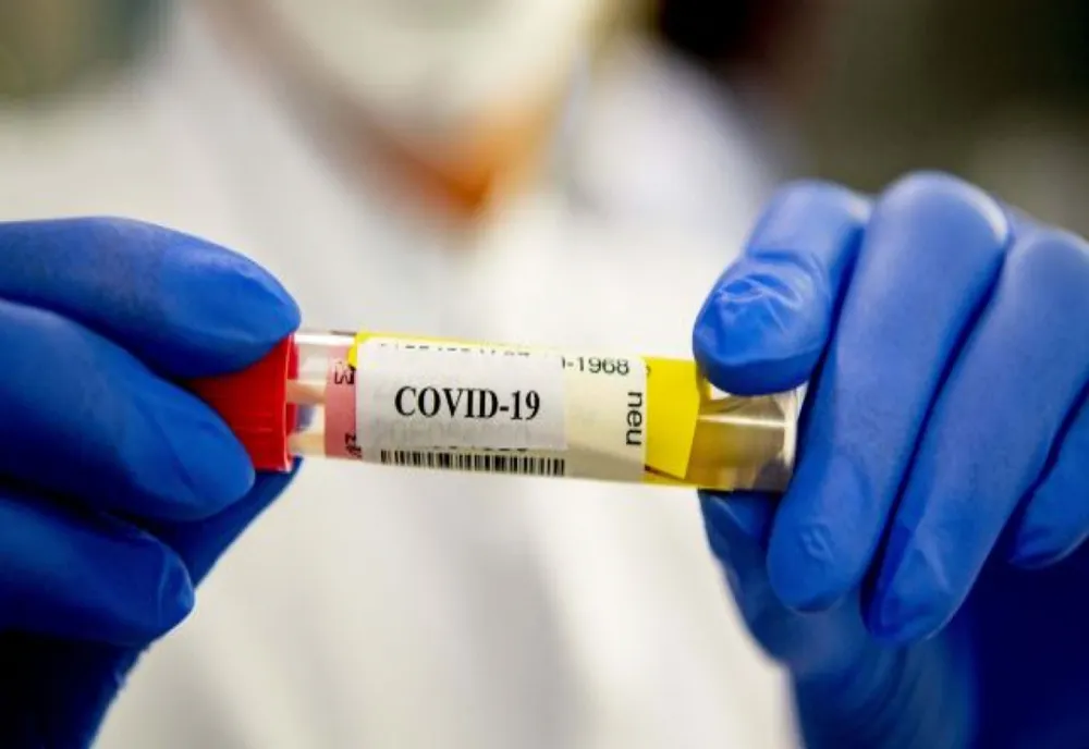 Coronavirus, cifre ÎN CREŞTERE: 4.342 cazuri noi şi 101 decese | RAPORT pe judeţe