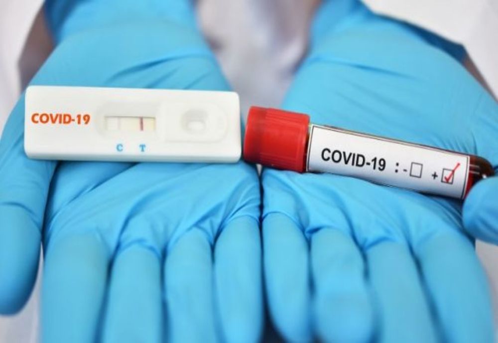 Testele rapide antigen pot fi făcute în farmacii