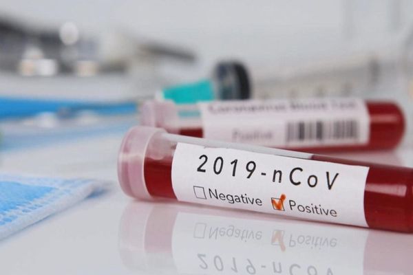 29 noi cazuri de coronavirus în România. Bilanțul ajunge la 246 de infectări 