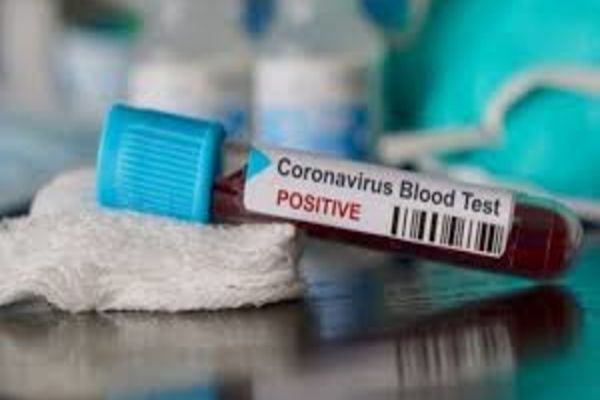 Autoritățile au anunțat cu puțin timp în urmă noi decese în România, ca urmare a infecției cu coronavirus. Bilanțul deceselor în România - 203 