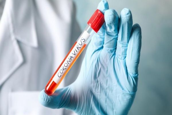 Au fost înregistrate alte 231 de noi cazuri de îmbolnăvire cu COVID-19. Bilanțul în România a ajuns la 15.362 de cazuri