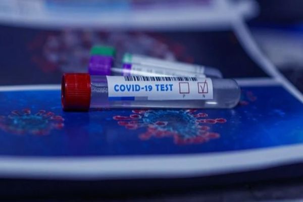 Numărul cazurilor noi de infectări cu coronavirus rămâne ridicat. 413 cazuri noi și 17 decese înregistrate în ultima zi