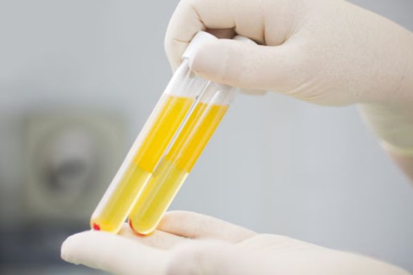 Procedura de donare de plasmă, simplificată. Care sunt noile condiții