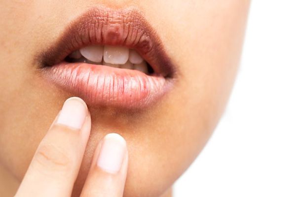 Simptomul rar de COVID care apare la nivelul gurii. Detaliul care trebuie să te trimită urgent la medic