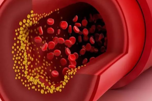 Cel mai periculos obicei alimentar care ne scurtează viața