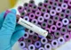 A fost confirmat primul caz de coronavirus din Bihor