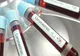 CORONAVIRUS ROMÂNIA: 187 de cazuri noi de coronavirus în ultimele 24 de ore